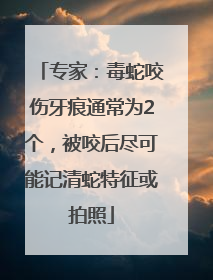 专家：毒蛇咬伤牙痕通常为2个，被咬后尽可能记清蛇特征或拍照
