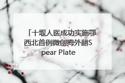 十堰人医成功实施鄂西北首例微创拇外翻Spear Plate髓内板矫形术